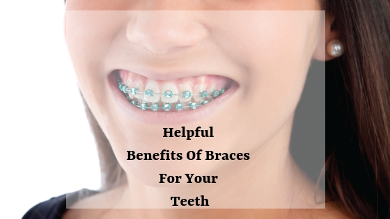 Braces center in muscat